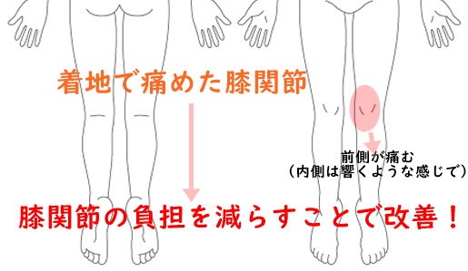 着地で痛めた膝関節