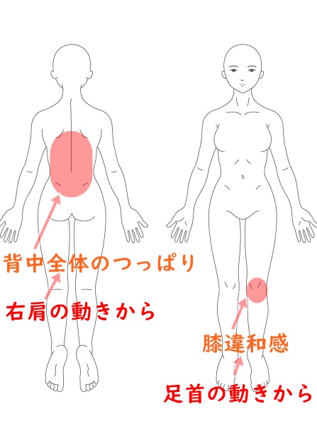 スポーツ鍼灸