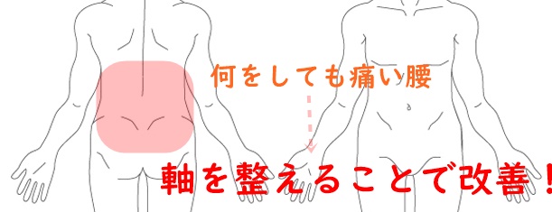 何をしても痛い腰　腰痛