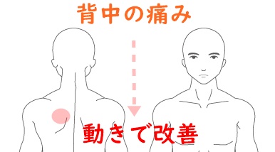 背中の痛み