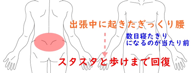 ぎっくり腰が出張中に起きる