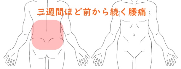 慢性腰痛　伸ばすと痛い