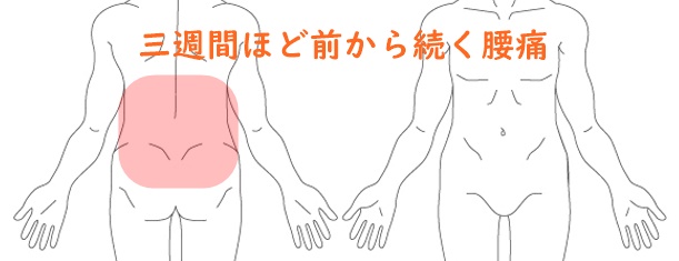 慢性腰痛　伸ばすと痛い