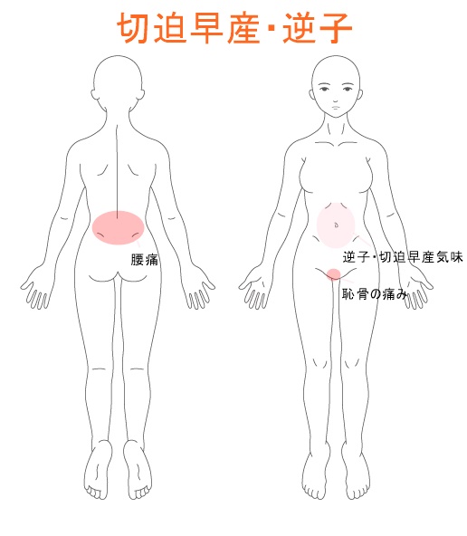 切迫早産・逆子・妊産婦さん