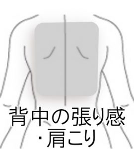 背中の痛み 室蘭登別 すのさき鍼灸整骨院 肩こり 腰痛 自律神経失調症 頭痛専門院