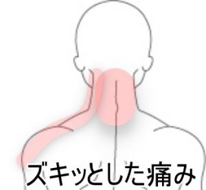 首の痛み 室蘭登別 すのさき鍼灸整骨院 肩こり 腰痛 自律神経失調症 頭痛専門院