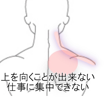 上 を 向く と 肩 が 痛い 首 肩が痛くて上を向けない 原因と対策を詳しく解説 Docstest Mcna Net