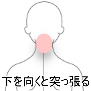 下を向くと突っ張る 室蘭登別 すのさき鍼灸整骨院 肩こり 腰痛 自律神経失調症 頭痛専門院