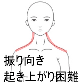 首から下が動かなくなりそうな寝違え 室蘭登別 すのさき鍼灸整骨院 肩こり 腰痛 自律神経失調症 頭痛専門院