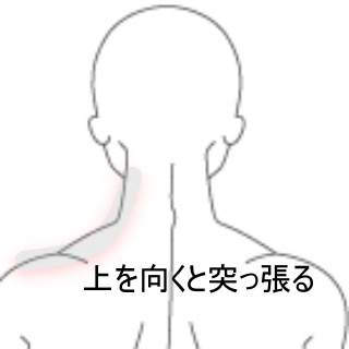 上を向くと肩上部から背中が突っ張る 室蘭登別 すのさき鍼灸整骨院 肩こり 腰痛 自律神経失調症 頭痛専門院