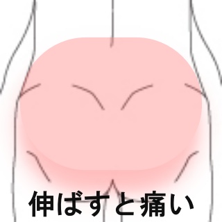 が 重い 腰